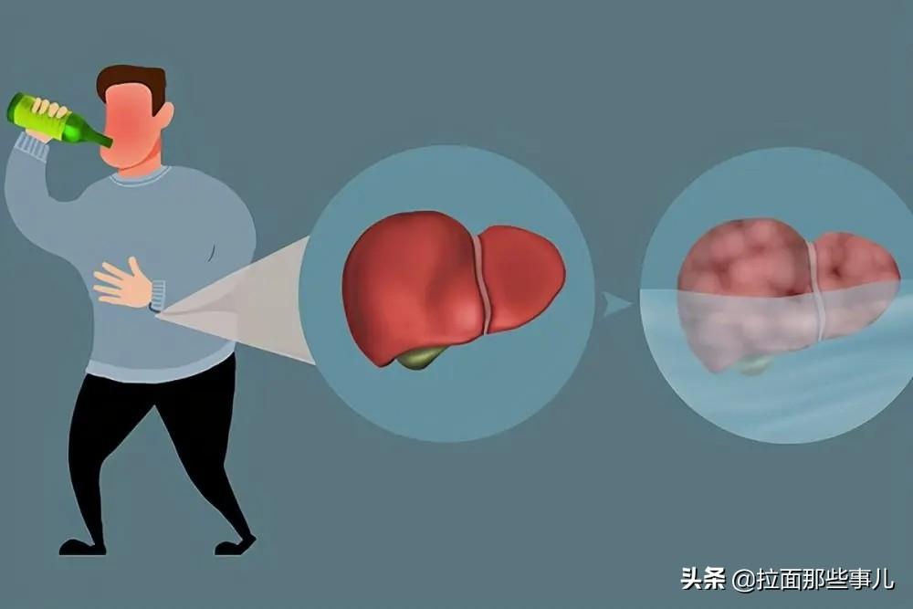 白酒标签标准_杂醇油的去除_白酒杂醇油标准